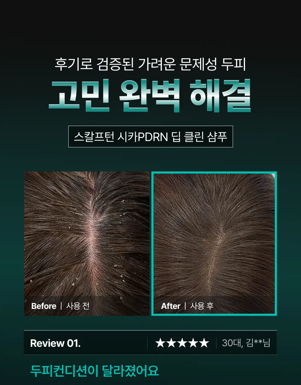 [포켓몬 에디션][비듬/각질케어]릴리이브 스칼프턴 시카 PDRN 딥클린 샴푸 500g 2종 택1 상세페이지 20